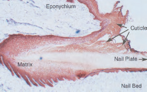 Where's the Cuticle? by Doug Schoon